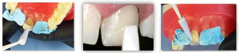 estethic plus tdv 2