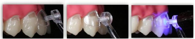 matriz cervical 2