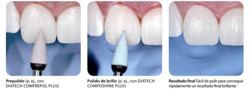 Todo lo que debes conocer acerca de la resina BRILLIANT EverGlow® 5 Brillo Brilliant EverGlow coltene