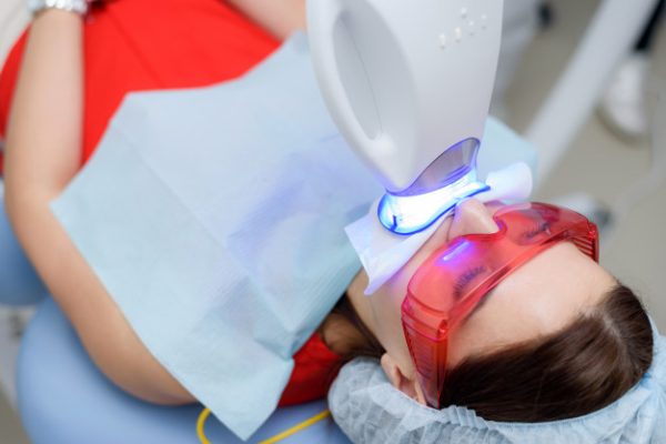 Lee más sobre el artículo Blanqueamiento dental: déjelo en manos de los dentistas