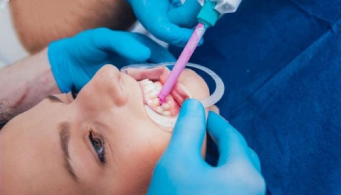 Lee más sobre el artículo ¿Por qué usar silicona para el registro de mordida de nuestro paciente?